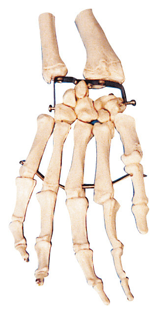 Modelo de treinamento humano do modelo da anatomia do osso da palma para a Faculdade de Medicina