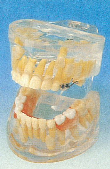 Modelo humano dos dentes das escolas dentais/modelo transparente do desenvolvimento de dentes do leite