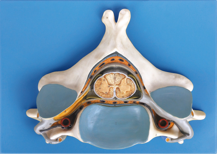 Quinto Vertrebra cervical com modelo de esqueleto humano anatômico da medula espinal e do nervo
