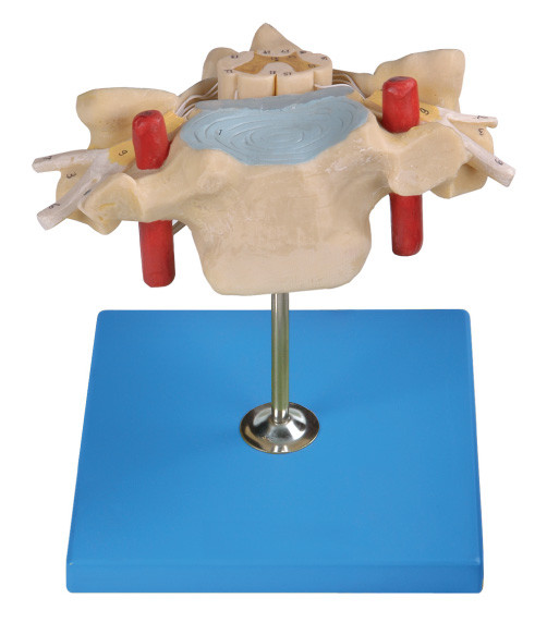 Vertrebra cervical com modelo humano da anatomia da medula espinal mostra a artéria espinal, veia, nervo