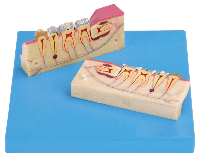 12 posições são indicadas do modelo Dissected do tecido dos dentes