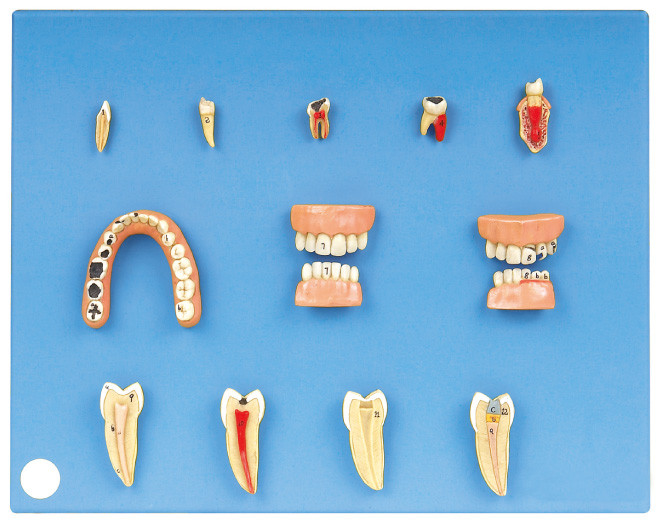 Modelo dental das doenças feito de PVC avançado para o estágio e a formação dos estudantes