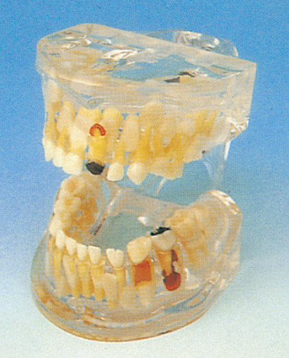 O modelo humano dos dentes/patologia lúcido dos dentes de leite modela para a formação das escolas dentais