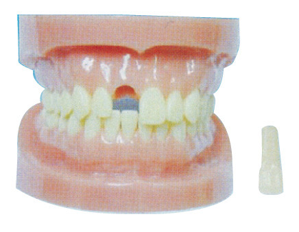 Modelo destacável dos dentes sem a raiz para hospitais e o treinamento dental da prevenção