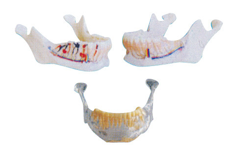Os dentes do dentista modelam o modelo mandibular com nervos, artérias e veias