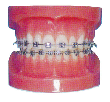 Modelo humano ortodôntico dos dentes para hospitais e o treinamento dental do hospital