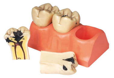 Modelo humano dissecado dos dentes da doença dental para o estágio e a formação dos estudantes