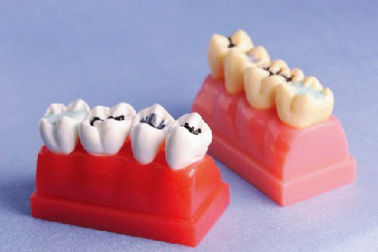 Modelo humano dos dentes para um modelo da demonstração do vedador e do embutimento de 4 vezes Lifesize